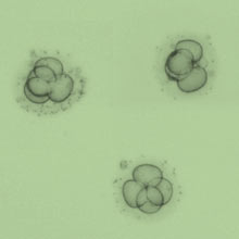 Kinderwunsch - Embryotransfer bei In Vitro Fertilisation