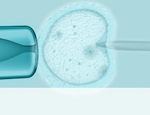 Künstliche Befruchtung - IVF Wien